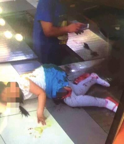 北京8岁女童掉进百盛商场扶梯被割伤